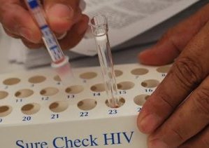 Protege el ISSSTE a derecho-habientes detectados con VIH